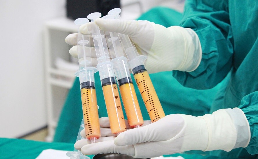 Lipofilling